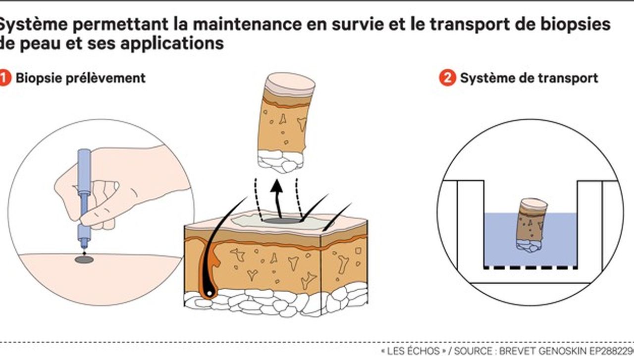 Genoskin Un Brevet Pour Conserver Vivants Des Echantillons De Peau Humaine Les Echos