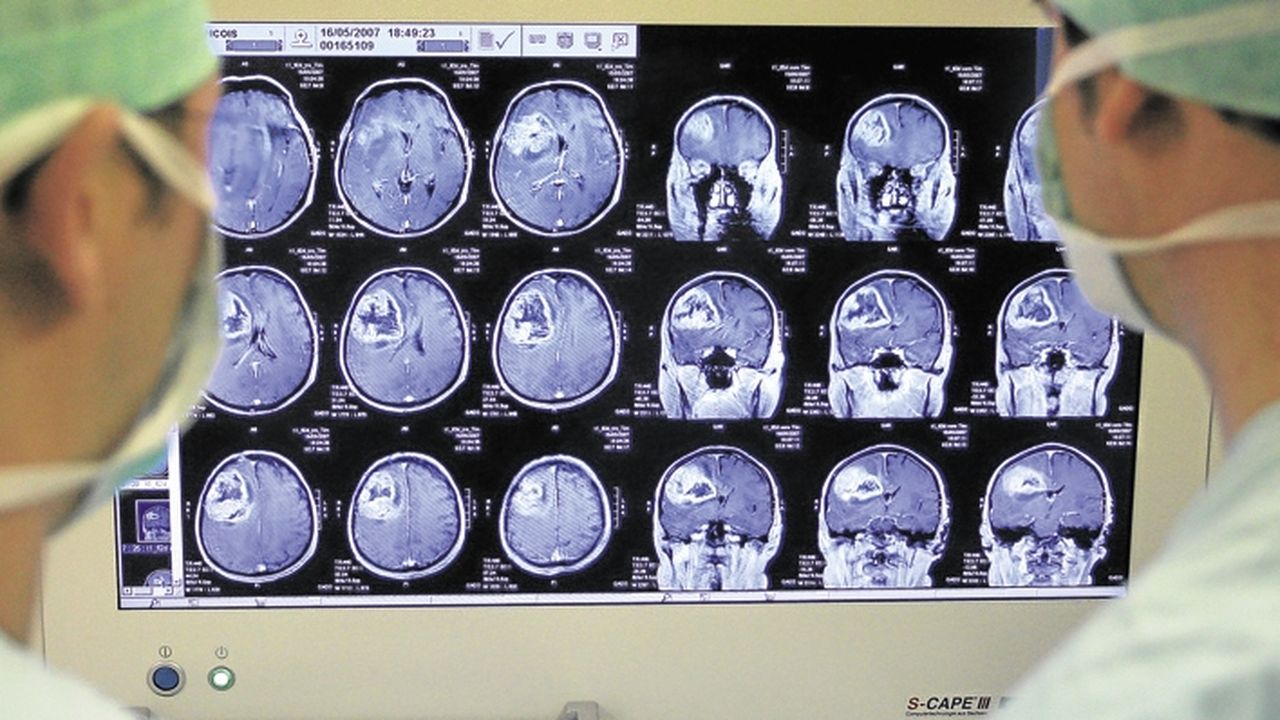Comment l'IRM change notre vision du cerveau | Les Echos