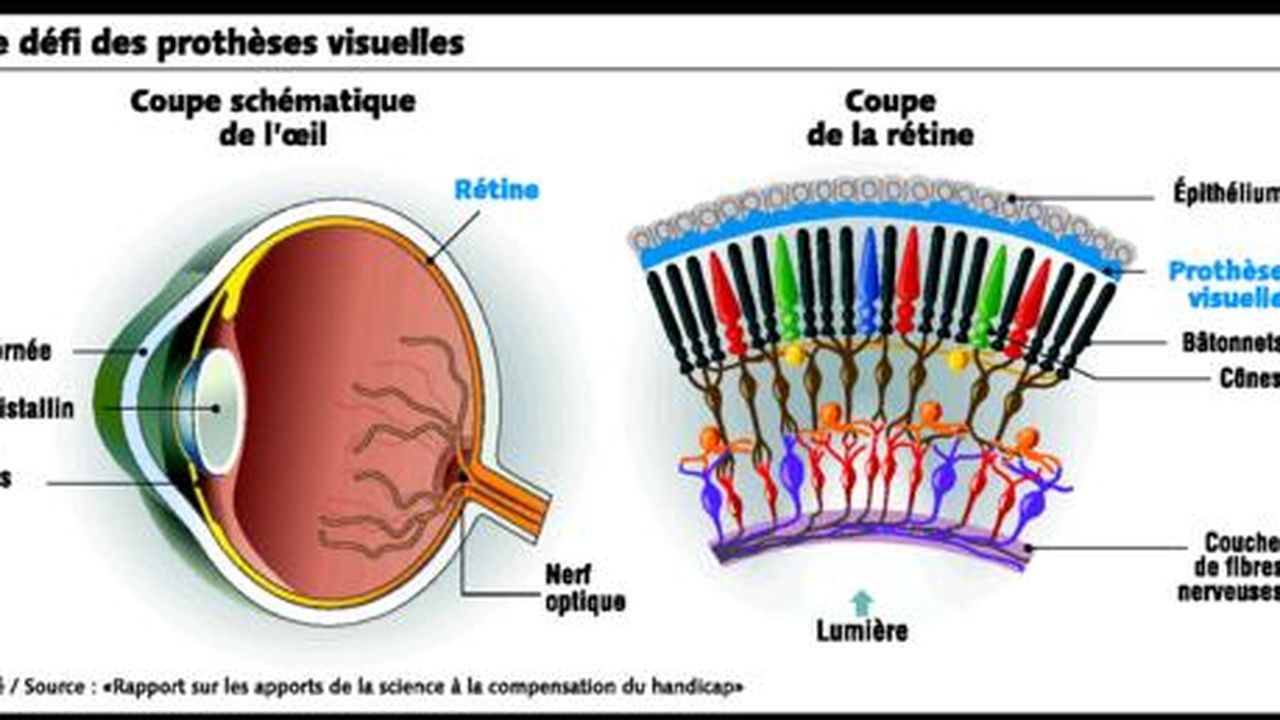 Quand la technique pallie le handicap | Les Echos