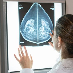 L'équipe a programmé le système pour qu'il puisse identifier les cancers du sein sur des dizaines de milliers de mammographies.
