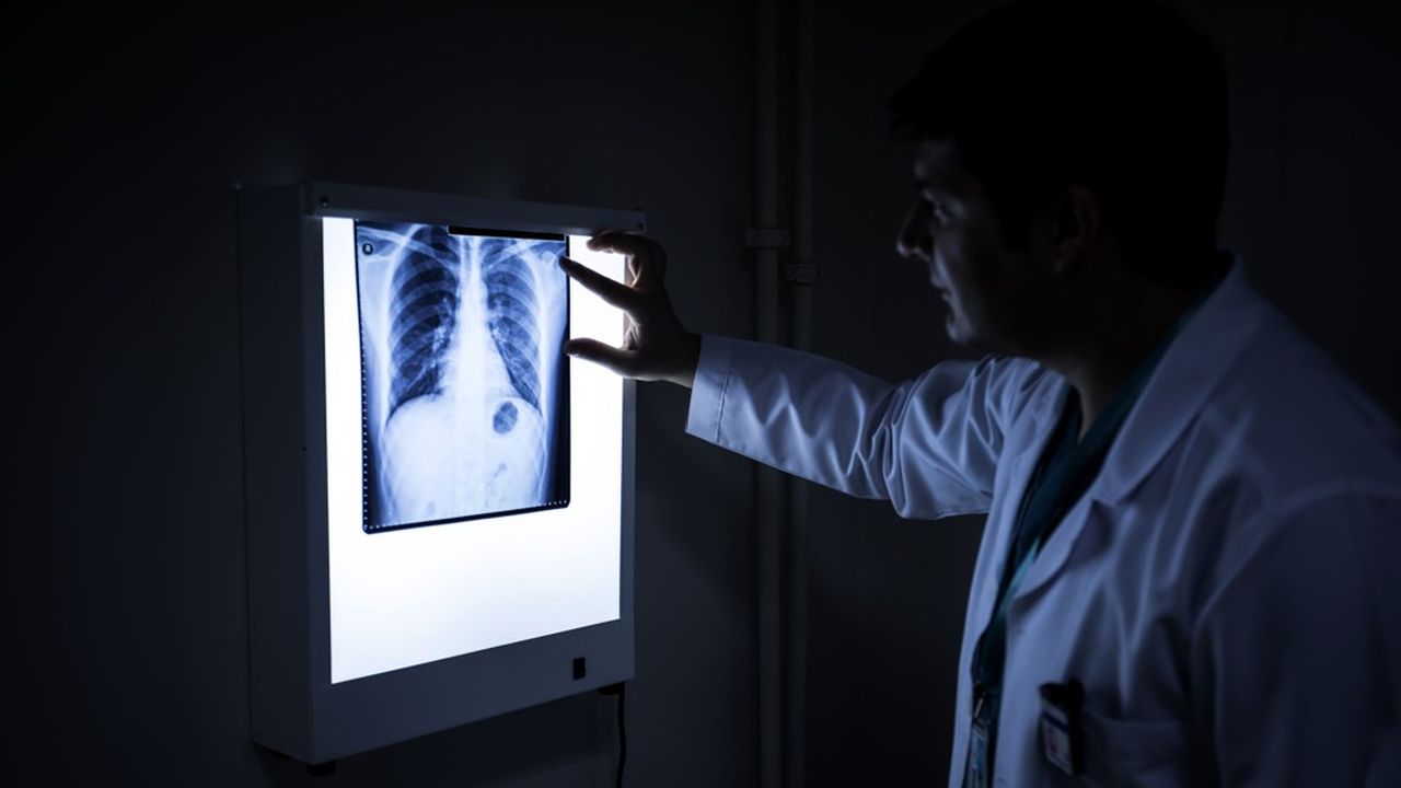 Les malades atteints de la forme la plus répandue de cancer du poumon ont vu leurs perspectives radicalement transformées avec la possibilité de gagner 16 mois d'espérance de vie grâce au Keytruda.