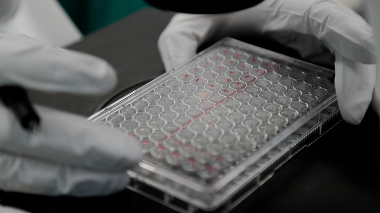 Pour essayer d'identifier un facteur génétique susceptible d'expliquer les différences, les experts nippons ont prévu de récolter des échantillons sanguins de 600 personnes ayant été contaminées par le covid-19 mais n'ayant pas été touchées de la même manière par la maladie.