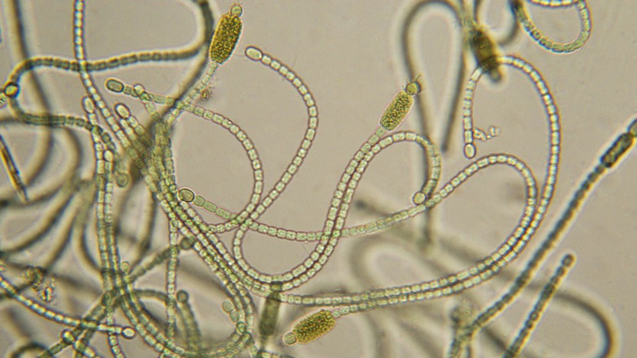 Les cyanobactéries, aussi appelées algues bleues, prolifèrent surtout en été dans les étendues d'eau stagnantes et les rivières.
