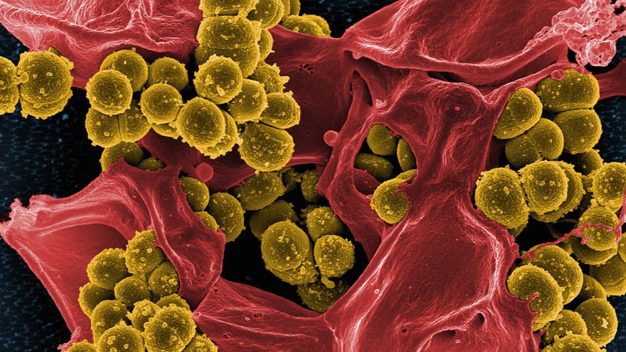La bactérie staphylocoque doré arrive en tête des pathogènes responsables d'infections nosocomiales.