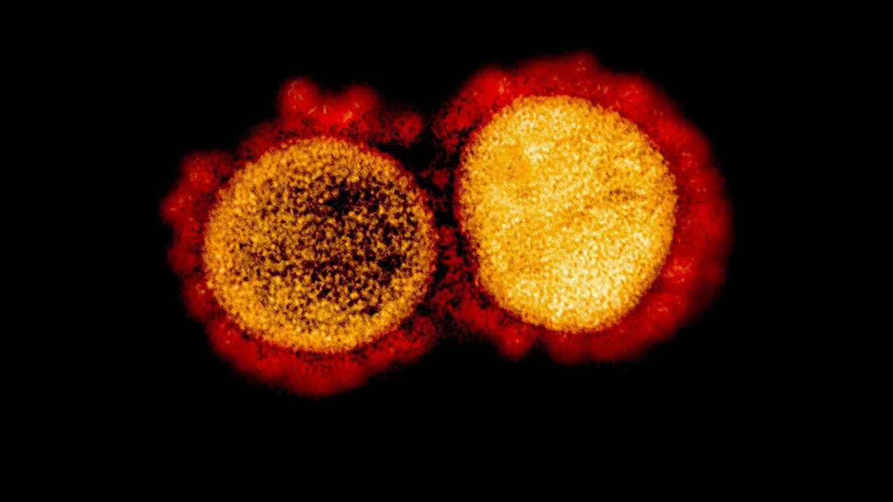 Les particules virales du SARS-CoV-2 vues au microscope électronique.