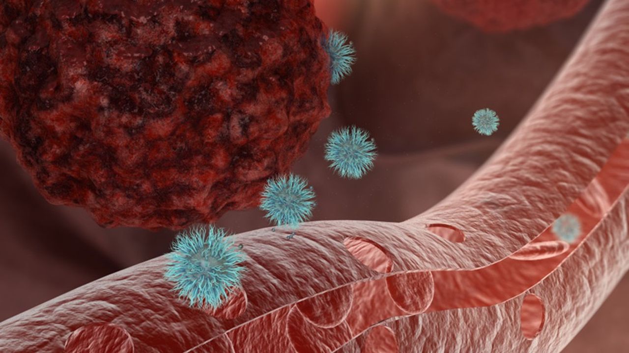 Les nanoparticules permettent d'augmenter l'efficacité de la radiothérapie sur les tumeurs solides, tout en préservant les tissus sains environnants.