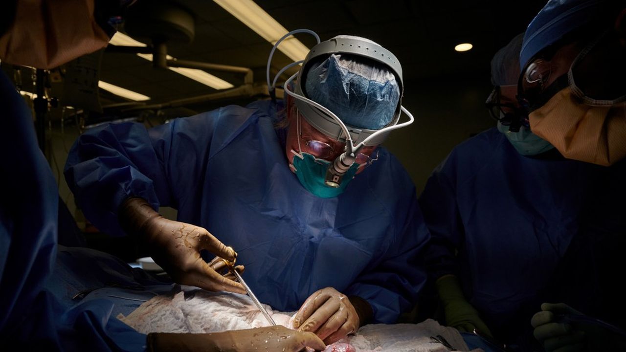 Le Dr Robert Montgomery, chirurgien au NYU Langone et directeur de son Institut de la transplantation, en train de réaliser la première xénogreffe sur une patiente en état de mort cérébrale.