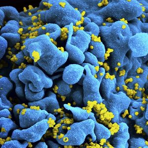 Image colorisée d'un lymphocyte T (Th9) infecté par le VIH.