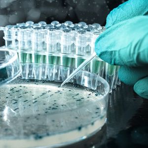 Les demandes d'autorisations dans la santé ont doublé, en particulier dans les biotechs « présentant des risques importants pour la sécurité publique », estime le Trésor.