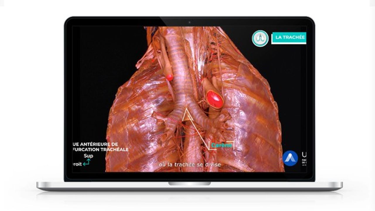 Akivi fait appel à la réalité virtuelle et à la 3D pour accompagner les étudiants et professionnels de la santé dans l'apprentissage de l'anatomie.
