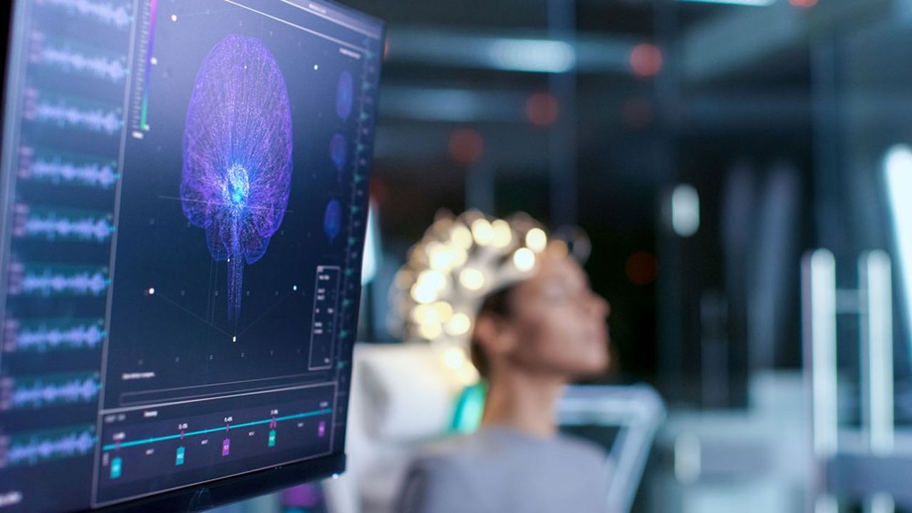 Contrairement à ce que propose Neuralink, qui a testé ses premiers implants cérébraux en greffant des capteurs dans le cerveau de singes, Synchron adopte une approche moins invasive.