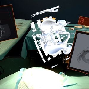 Surgiverse comporte une plateforme de planification avec tous les outils d'imagerie en 3D et un « cockpit » d'assistance en réalité mixte pour la salle d'opération.