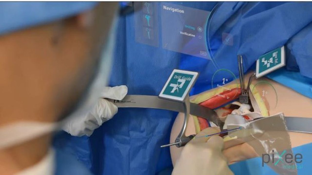 PIxee Medical a mis au point la solution Shoulder + qui permet au chirurgien équipé de lunettes connectées de voir les os à travers les champs opératoires.