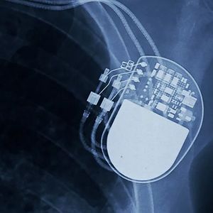 La start-up Implicity analyse les données des pacemakers connectés.