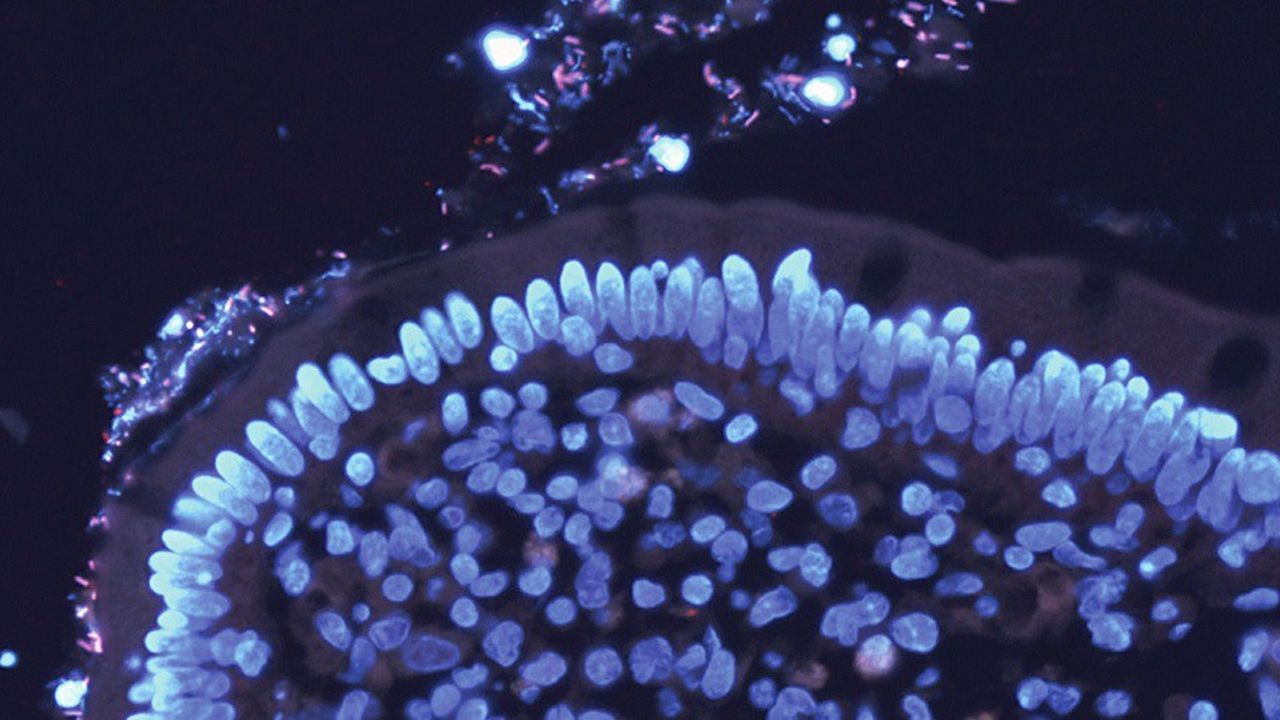 La bactérie Faecalibacterium prausnitzii a fait l'objet d'une dizaine d'années de recherches scientifiques.