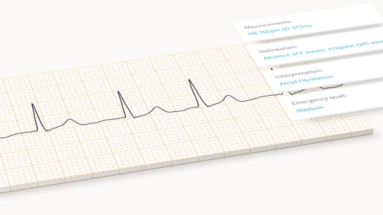 Avec ses algorithmes, Cadiologs permet de détecter des anomalies cardiaques lors d’un simple électrocardiogramme.
