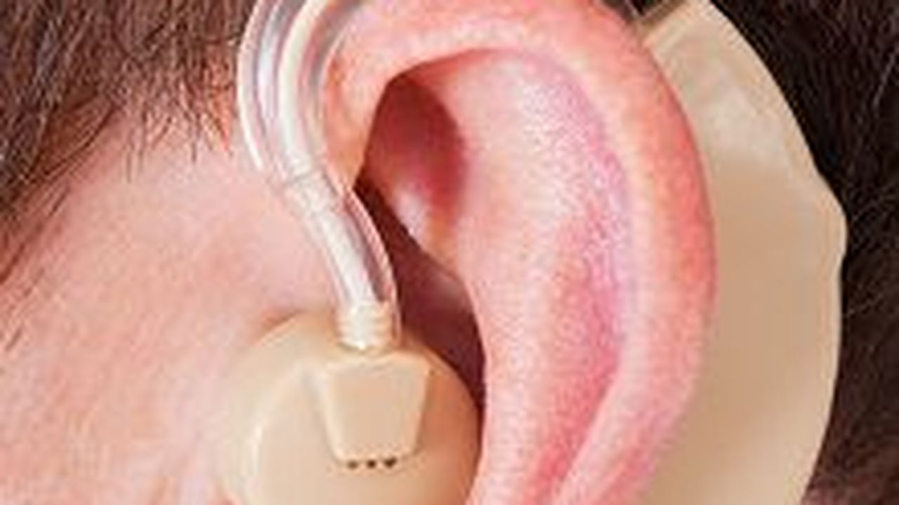Le marché de l'aide auditive continue doucement son essor