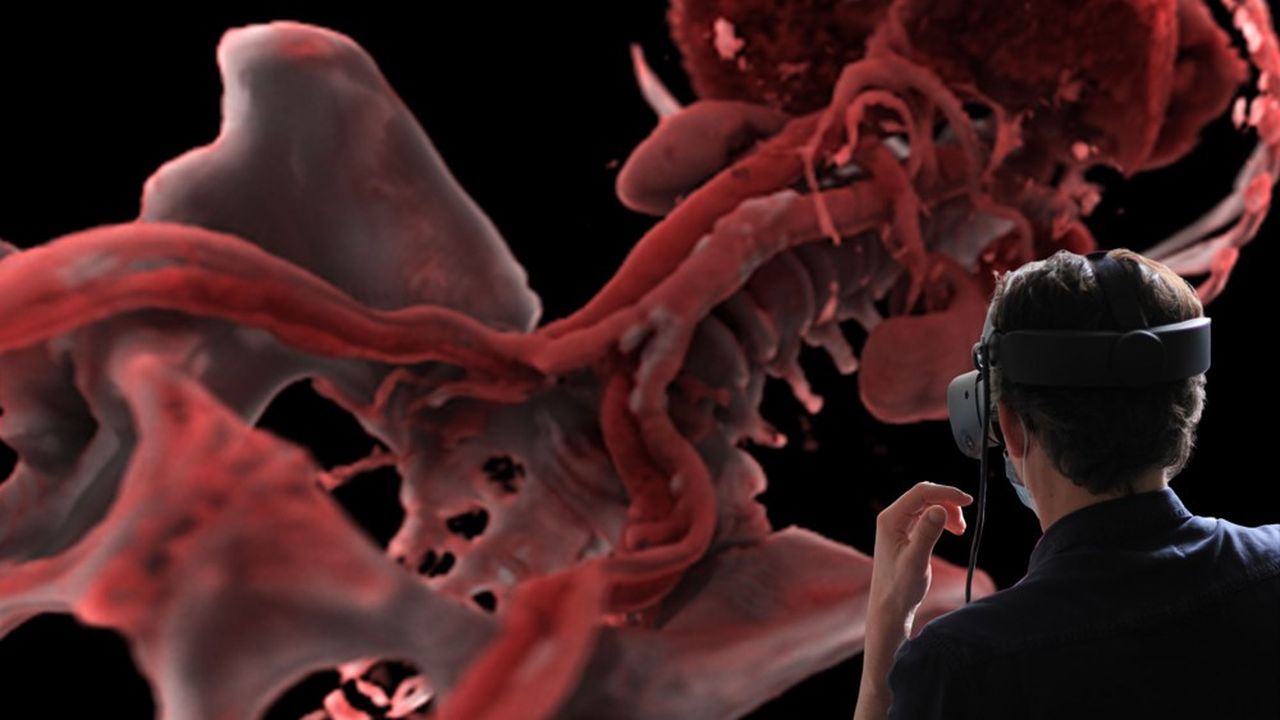 Basée sur la réalité virtuelle, la solution logicielle d'Avatar Medical cible en priorité les domaines de l'oncologie, du cardiovasculaire et de l'orthopédie (épaule et colonne vertébrale).