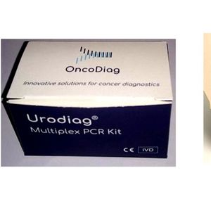 Le test d'OncoDiag est basé sur un échantillon d'urine, à la fois indolore pour les patients, simple pour les praticiens et moins coûteux pour le système de santé.