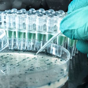 Le secteur des biotechs ne se limite pas qu'aux produits pharmaceutiques tels que l'ARN messager. Les bio-engrais, les bioplastiques ou encore les biotextiles en font aussi partie.